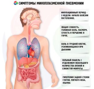 Симптомы микоплазменной пневмонии